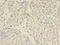 STEAP3 Metalloreductase antibody, LS-C377755, Lifespan Biosciences, Immunohistochemistry paraffin image 