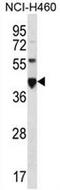 Carcinoembryonic Antigen Related Cell Adhesion Molecule 18 antibody, AP50844PU-N, Origene, Western Blot image 