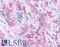 Protein Kinase D3 antibody, LS-A7345, Lifespan Biosciences, Immunohistochemistry paraffin image 