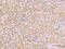 TNF Receptor Superfamily Member 13B antibody, 201404-T08, Sino Biological, Immunohistochemistry paraffin image 