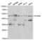 Potassium Calcium-Activated Channel Subfamily N Member 4 antibody, PA5-76647, Invitrogen Antibodies, Western Blot image 