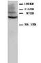 Junction Plakoglobin antibody, LS-C171892, Lifespan Biosciences, Western Blot image 