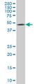 Ectodermal-Neural Cortex 1 antibody, LS-C139302, Lifespan Biosciences, Western Blot image 