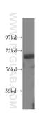 Apoptosis Antagonizing Transcription Factor antibody, 10282-1-AP, Proteintech Group, Western Blot image 