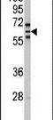 Cytochrome P450 Family 2 Subfamily C Member 8 antibody, PA5-15215, Invitrogen Antibodies, Western Blot image 