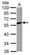 Mitogen-Activated Protein Kinase Kinase 7 antibody, GTX103563, GeneTex, Western Blot image 