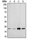 Transforming Growth Factor Beta 2 antibody, MBS821174, MyBioSource, Western Blot image 