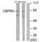 Nuclear Cap Binding Protein Subunit 1 antibody, A07424, Boster Biological Technology, Western Blot image 