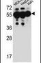 Sosondowah Ankyrin Repeat Domain Family Member C antibody, PA5-25701, Invitrogen Antibodies, Western Blot image 