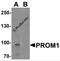 Prominin 1 antibody, 7783, ProSci, Western Blot image 