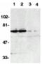 TNFRSF21 antibody, A04348, Boster Biological Technology, Western Blot image 