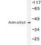 Actin Gamma 2, Smooth Muscle antibody, LS-C175910, Lifespan Biosciences, Western Blot image 