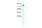 Zinc Finger Protein 57 antibody, 28-213, ProSci, Enzyme Linked Immunosorbent Assay image 