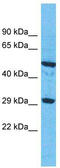 Olfactory Receptor Family 9 Subfamily G Member 1 antibody, TA337517, Origene, Western Blot image 