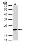 Fas Apoptotic Inhibitory Molecule antibody, GTX110991, GeneTex, Western Blot image 