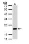 Fas apoptotic inhibitory molecule 1 antibody, GTX110991, GeneTex, Western Blot image 