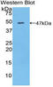 Myosin light chain 6B antibody, LS-C295515, Lifespan Biosciences, Western Blot image 