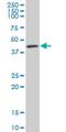 Kaptin, Actin Binding Protein antibody, H00011133-M01, Novus Biologicals, Western Blot image 