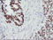 p53 antibody, LS-C172943, Lifespan Biosciences, Immunohistochemistry paraffin image 