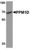 Protein Phosphatase, Mg2+/Mn2+ Dependent 1D antibody, A01576, Boster Biological Technology, Western Blot image 