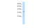 Potassium Voltage-Gated Channel Subfamily A Regulatory Beta Subunit 2 antibody, 28-296, ProSci, Western Blot image 