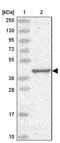 Dynein Assembly Factor With WD Repeats 1 antibody, NBP1-92591, Novus Biologicals, Western Blot image 