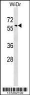 Sorting nexin-18 antibody, 59-123, ProSci, Western Blot image 