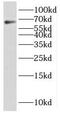 PARP2 antibody, FNab06156, FineTest, Western Blot image 