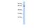 EBF Family Member 4 antibody, GTX48953, GeneTex, Western Blot image 