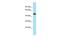 NOP2/Sun RNA Methyltransferase 5 antibody, PA5-46042, Invitrogen Antibodies, Western Blot image 