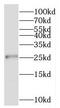 Ribosomal Protein L13a antibody, FNab07413, FineTest, Western Blot image 