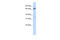 E3 ubiquitin-protein ligase TRIM23 antibody, 25-041, ProSci, Enzyme Linked Immunosorbent Assay image 