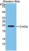 Glucosidase Alpha, Acid antibody, LS-C373899, Lifespan Biosciences, Western Blot image 