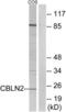 Cerebellin 2 Precursor antibody, LS-C119840, Lifespan Biosciences, Western Blot image 