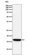 NME/NM23 Nucleoside Diphosphate Kinase 1 antibody, M01334, Boster Biological Technology, Western Blot image 