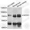 Acyl-CoA Oxidase 1 antibody, A8091, ABclonal Technology, Western Blot image 