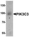 Phosphatidylinositol 3-Kinase Catalytic Subunit Type 3 antibody, A02356, Boster Biological Technology, Western Blot image 