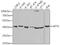 Aprataxin antibody, GTX33016, GeneTex, Western Blot image 