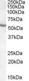 Arylsulfatase A antibody, PA5-18591, Invitrogen Antibodies, Western Blot image 