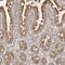 C12orf49 antibody, HPA026905, Atlas Antibodies, Immunohistochemistry paraffin image 