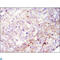 Protein Tyrosine Kinase 2 antibody, LS-C812597, Lifespan Biosciences, Immunohistochemistry paraffin image 