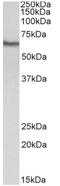 CD224 antibody, AP32725PU-N, Origene, Western Blot image 