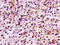 CDw210b antibody, CSB-PA600091LA01HU, Cusabio, Immunohistochemistry frozen image 