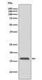 Cytochrome C Oxidase Subunit 4I1 antibody, M05442, Boster Biological Technology, Western Blot image 