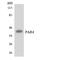 F2R Like Thrombin Or Trypsin Receptor 3 antibody, A03645-1, Boster Biological Technology, Western Blot image 