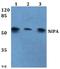 Zinc Finger C3HC-Type Containing 1 antibody, A07135S350, Boster Biological Technology, Western Blot image 