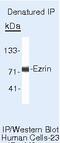 Ezrin antibody, MA5-13862, Invitrogen Antibodies, Immunoprecipitation image 