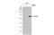 Glutamate Decarboxylase 2 antibody, GTX100281, GeneTex, Western Blot image 