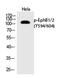 EPH Receptor B1 antibody, PA5-40236, Invitrogen Antibodies, Western Blot image 