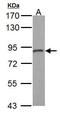 Stromal Interaction Molecule 1 antibody, GTX113558, GeneTex, Western Blot image 